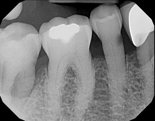 MB #29 Instead of Monster MOB by Dr. Arthur R. Volker