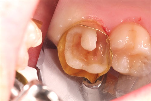 Greater Curve Standard Brass Band- MODL composite #2