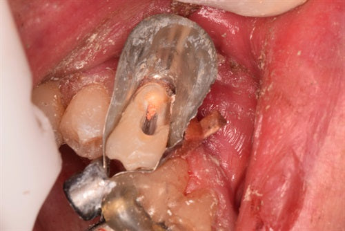 New Greater Curve U-Band in action