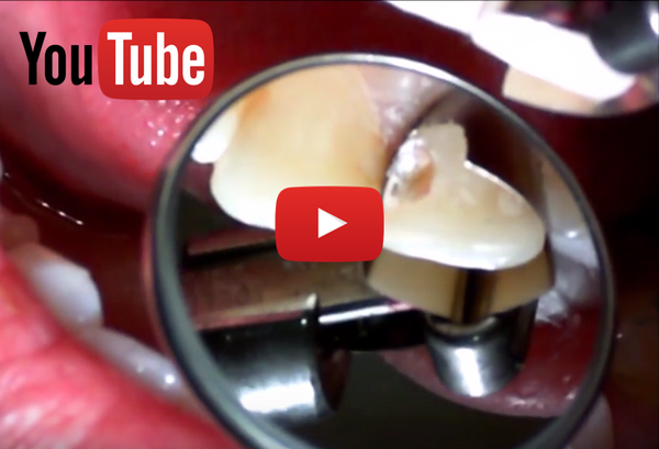 VIDEO: Greater Curve Wide - Class III #9