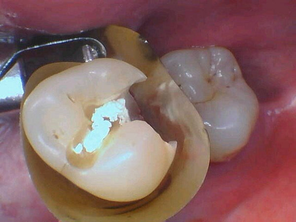 Deep Decay Restoration